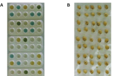 Fig. 2. Analyses of F2 seeds derived from the cross between triple mutant lacking all isozymes and normal type.