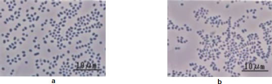 Fig. 1. Photomicrographs of methanotrophic bacteria Methylosinus spp.
