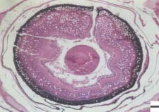 Fig. 2. Light micrograph showing vacuolation in the retina of affected orange-spotted grouper larvae.