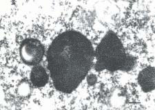 Fig. 3. Electron micrograph of virus particles in the brain cytoplasm of affected orange-spotted grouper.