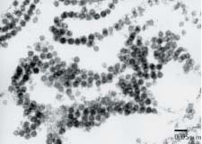 Fig. 4. Electron micrograph of virus particles in the brain cytoplasm of experimentally infected orange-spotted grouper.