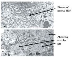 Fig. 2. Endoplasmic reticulum (ER) in tapetum at the uninucleate pollen stage.
