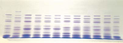 Fig. 1. SDS-gel electrophoresis of common wheat seed storage proteins.