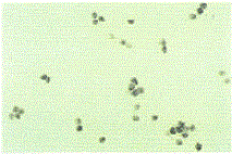 図1a CD11b陽性B細胞にみられたIL-10mRNAの発現