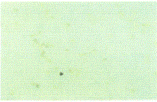 図1b CD11b陰性B細胞ではIL-10mRNAの発現がみられない