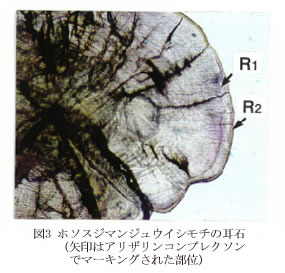 図3 ホソスジマンジュウイシモチの耳石